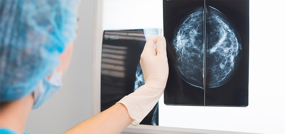 Implementación de una unidad de mamovigilancia para el diagnóstico de cáncer de mama en una microred de la seguridad social, Lima-Perú
