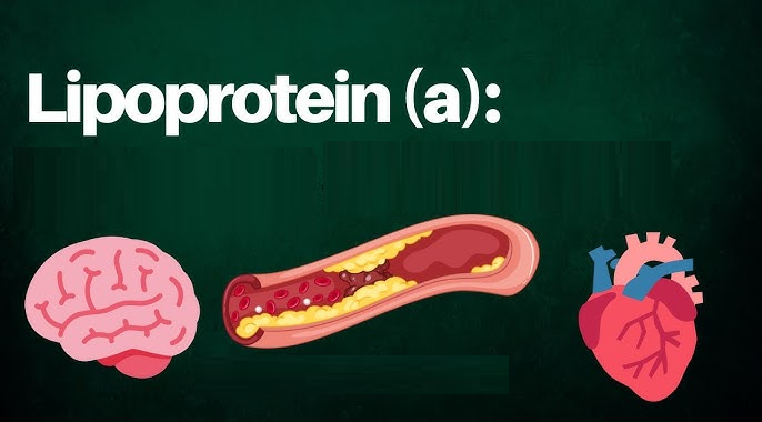 ¿Por qué incluir la Lipoproteína(a) en el perfil lipídico tradicional?