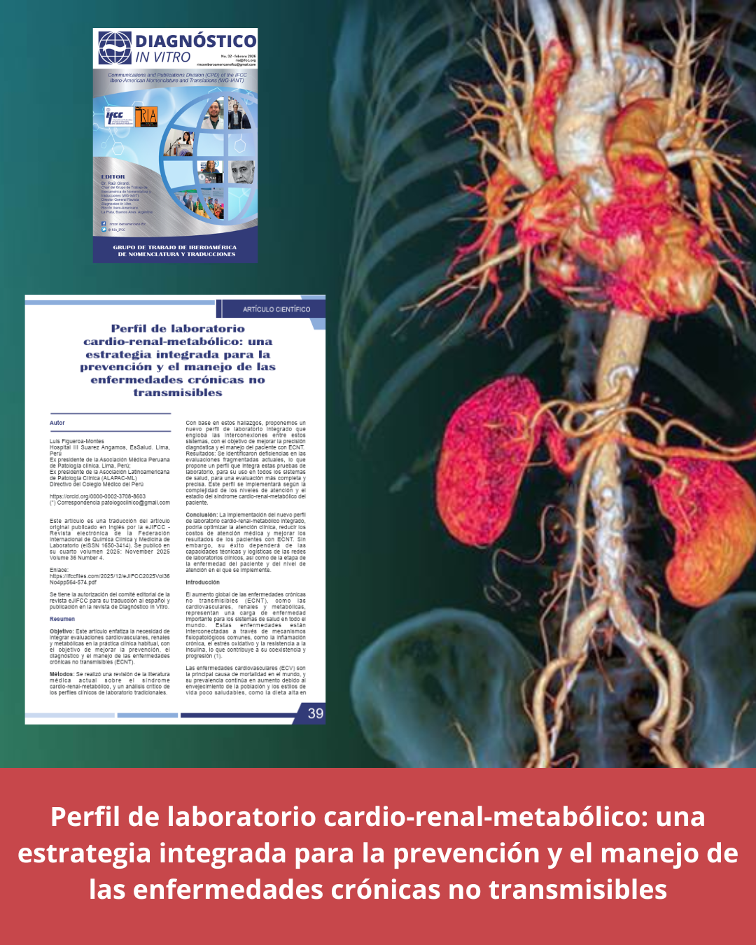 Perfil de laboratorio cardio-renal-metabólico: una estrategia integrada para la prevención y el manejo de las enfermedades crónicas no transmisibles